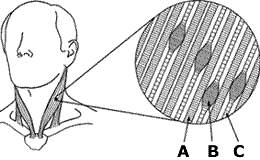 Gemiddeld Nauwgezet aanplakbiljet Triggerpoint/needling - Neuromusculair Therapeut Doede van der Bij